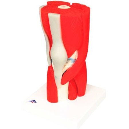 FABRICATION ENTERPRISES 3B® Anatomical Model - Knee Joint with Removable Muscles, 12-Part 959828